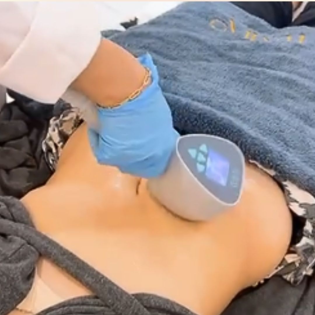 Exilift body treatment device