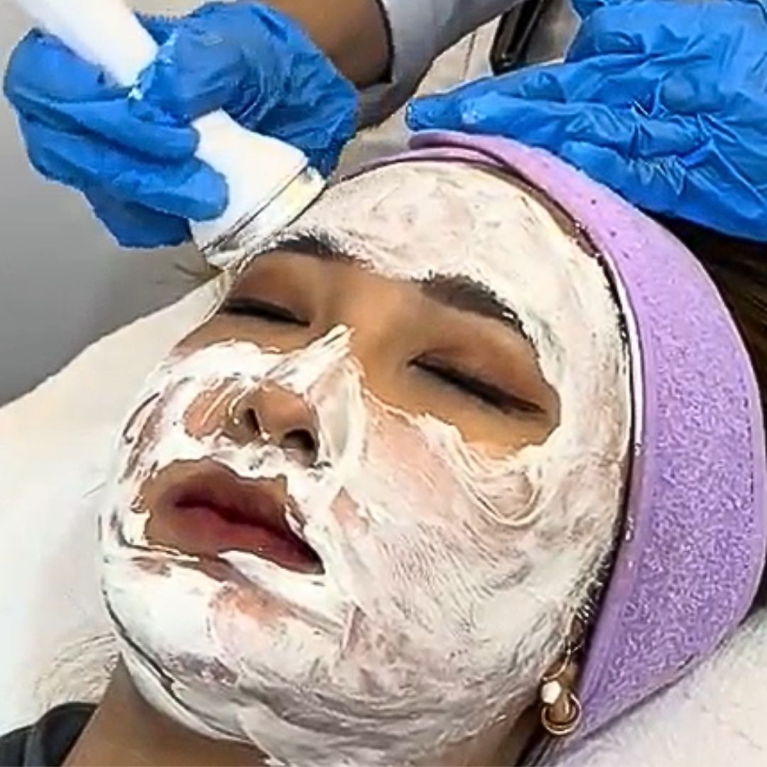 Anti-melasma facial treatment