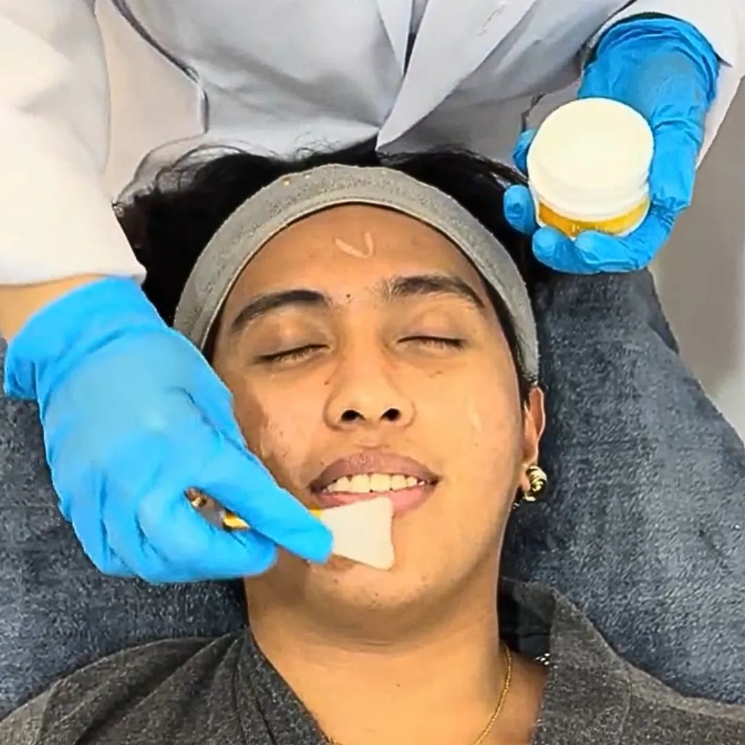 Collagen skin tightening treatment