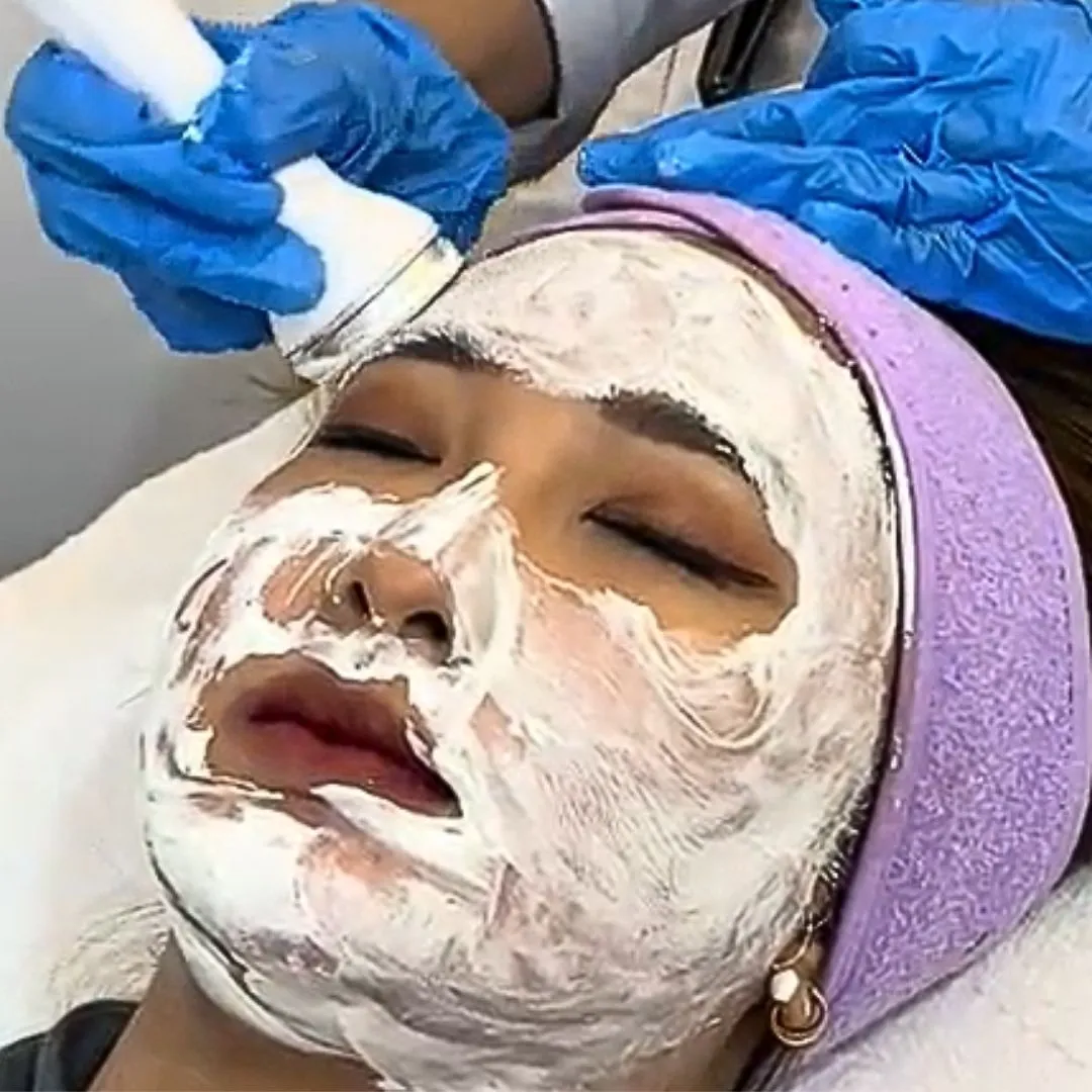 Anti-melasma facial treatment